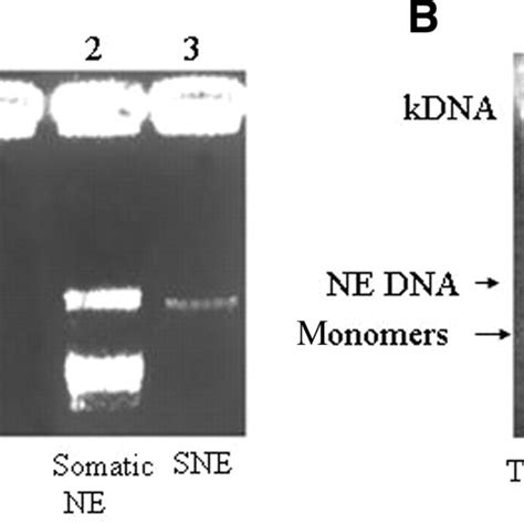 Inhibition Of Sperm Topo Ii A Or Purified Somatic Topo Ii B Dna