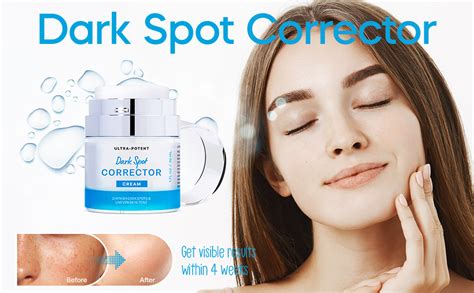 Bestkiss Dark Spot Corrector Cream Dark Spot Remover For Face And Body Age Spot