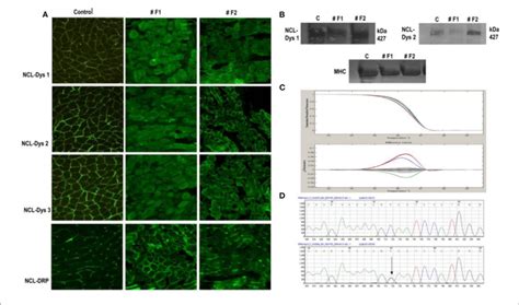 Immunofluorescent Staining Of Dystrophin In Normal Control Muscle And