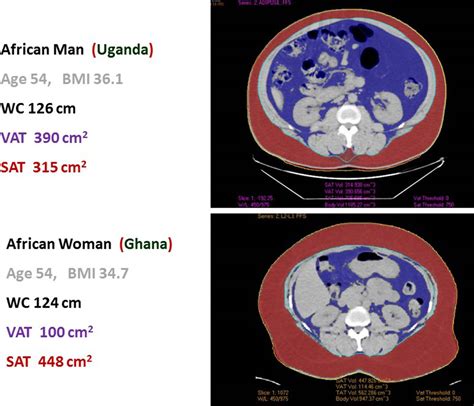 Do Current Guidelines For Waist Circumference Apply To Black Africans Prediction Of Insulin