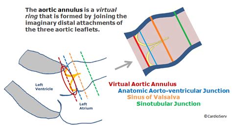 How To Master Aortic Measurements With These 5 Techniques Diagnostic