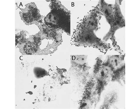 Adherence Patterns Of The E Coli Strains Examined A Aggregative