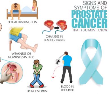 Prostate Cancer Overview -Causes ,Early Symptoms & Treatment