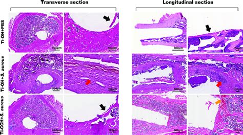 Histological Images Of Transverse And Longitudinal Sections From A