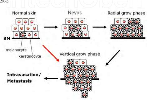 Figure 3 from Wnt β Catenin Signaling Pathway in Canine Skin Melanoma