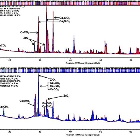 Diffractogram And Rietveld Analysis For Biodentine A Powder And B Download Scientific