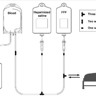 PDF Small volume plasma exchange for Guillain Barré syndrome in