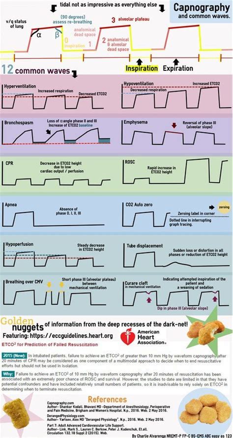 End Tidal Co2 Waveforms We Had A Big History Image Database