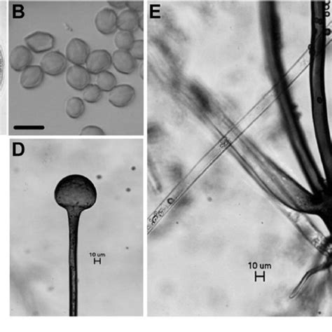 Symptoms Of Rhizopus Soft Rot On Oriental Melon Cucumis Melo Caused