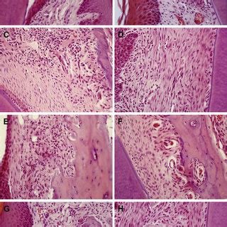 Histological Assessment Of Periodontal Destruction A Periodontal