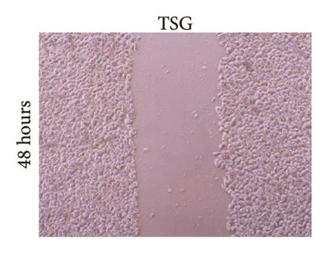 Tsg Suppressed Hepg Cell Migration A F Representative Images Of