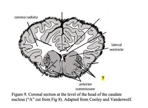 Sheep Brain Transverse Frontal Sections Flashcards Quizlet