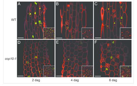 Hypocotyl Epidermal Phenotype Of Cop Confocal Images Of