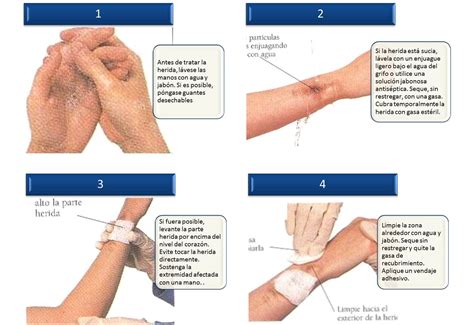 Primeros Auxilios En Heridas Y Hemorragias Hot Sex Picture