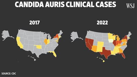 Public Health: The Rise Of The Deadly Fungi (WSJ) | Boomers Daily