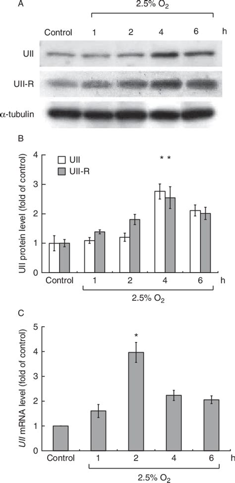 Figure 1 From Angiotensin II And The JNK Pathway Mediate Urotensin II