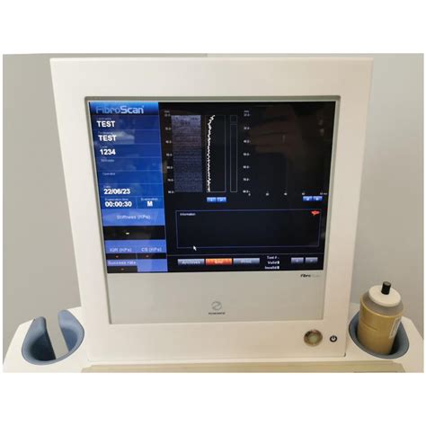 Transient Elastography Machine Echosens Fibroscan 502