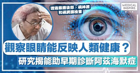 阿茲海默症 │ 觀察眼睛能反映人類健康？研究揭能助早期診斷阿茲海默症！ Medical Inspire 醫・思維