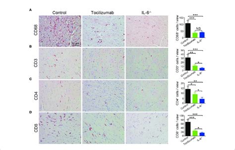 Blockade Of IL 6 IL 6R Signaling Reduces Macrophages And T Cells