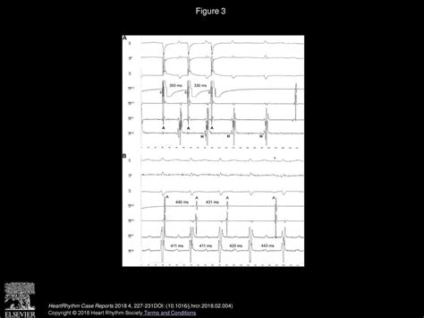 Claudio Hadid Md Sergio Gonzalez Md Jesús Almendral Md Phd Ppt Download