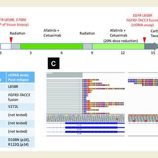 Fgfr Tacc Fusion Detected By Circulating Tumor Dna Ctdna Assay