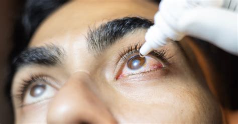 Amid Recalls, Are Eye Drops Safe to Use? - The New York Times