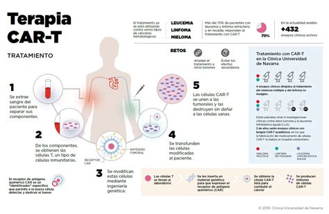 Terapia con células CAR T CART Cells Clínica Universidad de Navarra