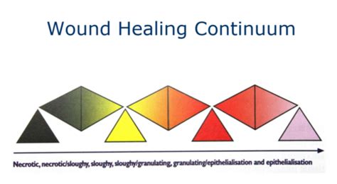 Complex Wounds And Dressings Flashcards Quizlet