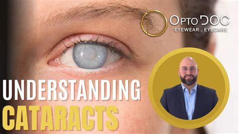 Cataracts Explained Causes Symptoms And Effective Treatments