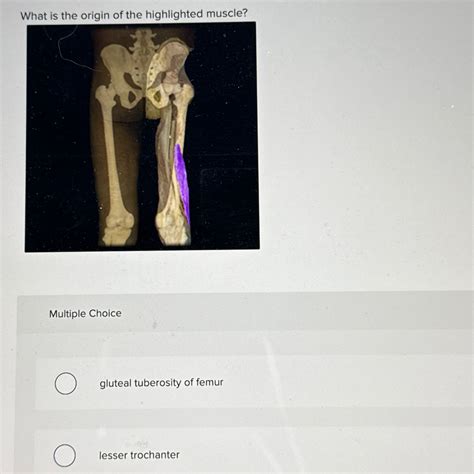 Solved What Is The Origin Of The Highlighted Muscle Multiple Chegg