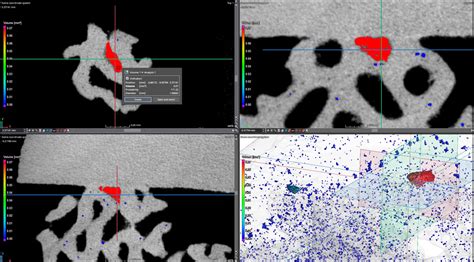 CT Scanning Printed Titanium Implants For Porosity Trapped Powder