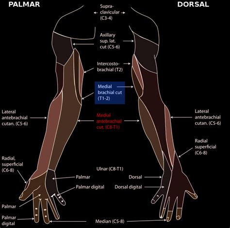 Anatomy Medial Antebrachial Cutaneous Nerve Statpearls Ncbi Bookshelf