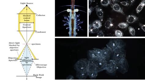 Dark Field Microscopy - Principle, Parts, Procedure, Uses - Biology ...