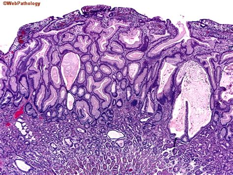 A Collection Of Surgical Pathology Images