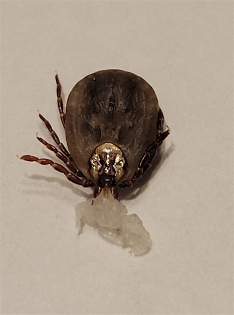 “When I pulled this tick off, my skin came with it!” – TickEncounter