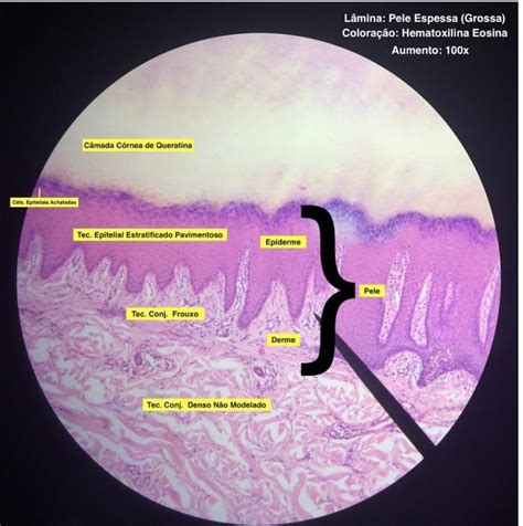 Histologia Tecido Conjuntivo Histologia E Embriologia Sexiz Pix