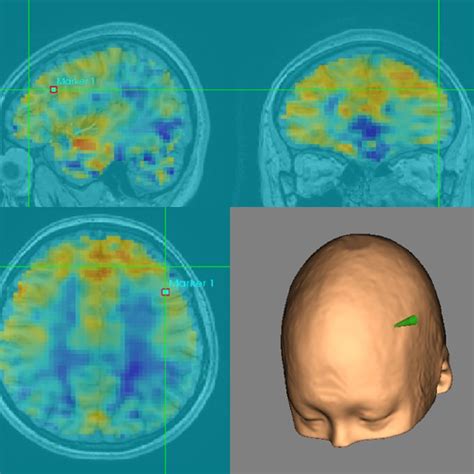 The Left Dorsolateral Prefrontal Cortex 44 40 29 Was Targeted Using