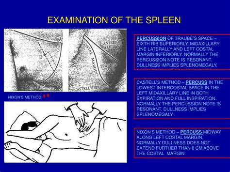 Ppt Physical Examination Of The Spleen Powerpoint Presentation Free Download Id 9152615