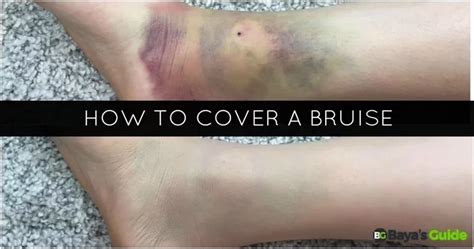 How To Cover A Bruise Two Easy Ways