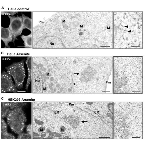 Ultrastructure Of Arsenite Induced Stress Granules In Human Cells Hela