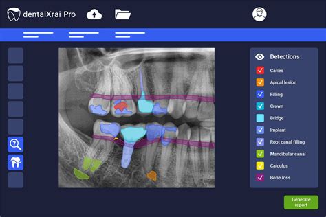 Software IA DentalXrai Pro 3 0 DentalXrai GmbH Hospitalar