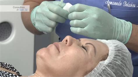 Prp Facial 6 Beneficios Para Rejuvenecer Tu Piel Benefimundo