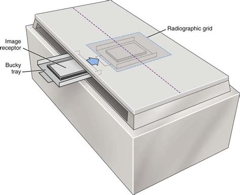 Radiographic And Fluoroscopic Equipment Radiology Key