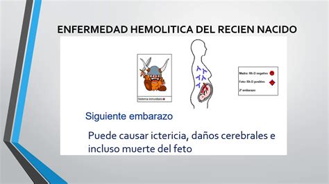 Curso Inmunohematología ENFERMEDAD HEMOLÍTICA DEL RECIÉN NACIDO