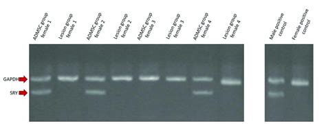 Identification Of Sry The Sex Determining Region Y Sry Gene Which