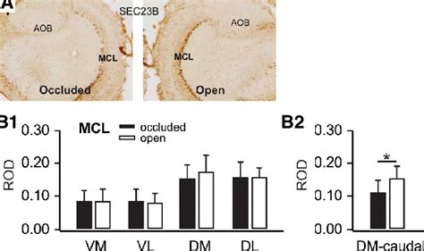 A Sec B Immunohistochemical Staining In Olfactory Bulbs Ipsilateral