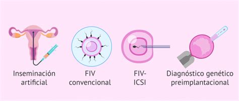 Qué tipos de técnicas de reproducción asistida existen