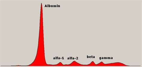 File:Serum protein electrophoresis normal.PNG - Wikipedia