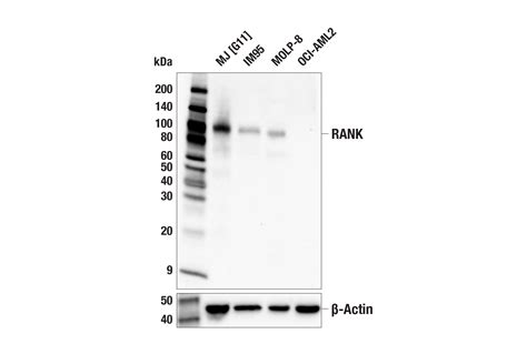 Rank E N Y Rabbit Mab Cell Signaling Technology