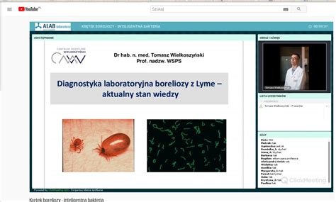 Borelioza Test Western Blot KKI Dariusz Mamczur